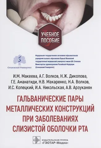 Наталья Жоржевна Дикопова, Ирина Михайловна Макеева Гальванические пары металлических конструкций при заболеваниях слизистой оболочки рта: учебное пособие