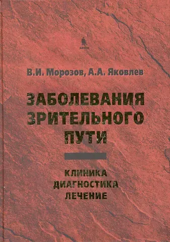 Заболевания зрительного пути: Клиника. Диагностика. Лечение.