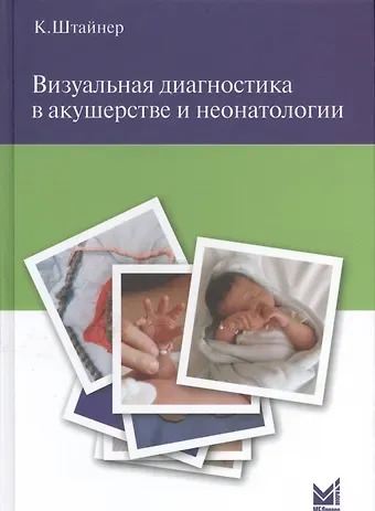 Керстин Штайнер Визуальная диагностика в акушерстве и неонатологии.