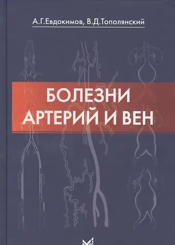 Анатолий Георгиевич Евдокимов Болезни артерий и вен / 2-е изд.