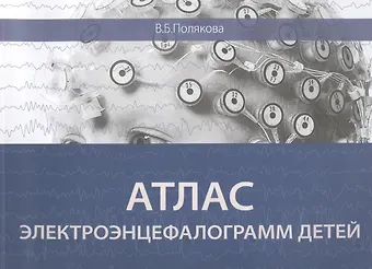 Вера Борисовна Полякова Атлас электроэнцефалограмм детей