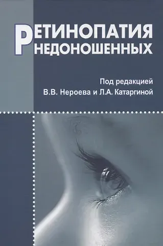 Ретинопатия недоношенных