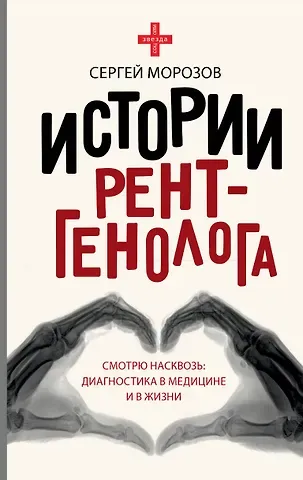 Сергей Павлович Морозов Истории рентгенолога. Смотрю насквозь: диагностика в медицине и в жизни.