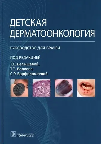 Светлана Рафаэлевна Варфоломеева, Тимур Теймуразович Валиев, Татьяна Сергеевна Белышева Детская дерматоонкология. Руководство для врачей