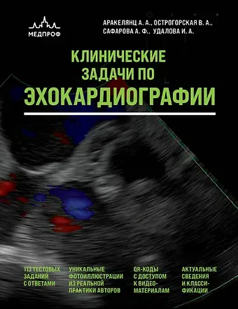 Аракелянц Амалия Ашотовна, Острогорская Вера Анатольевна, Сафарова Айтен Фуад кызы, Удалова Ирина Аркадьевна Клинические задачи по эхокардиографии
