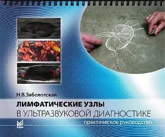 Наталия Владленовна Заболотская Лимфатические узлы в ультразвуковой диагностике