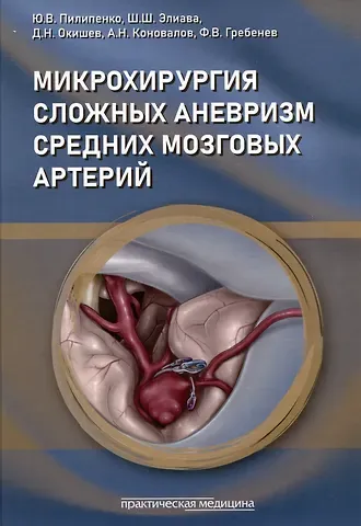 Юрий Викторович Пилипенко, Шалва Шалвович Элиава, Дмитрий Николаевич Окишев Микрохирургия сложных аневризм средних мозговых артерий: крупных, гигантских, фузиформных и частично тромбированных