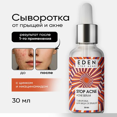 Сыворотка для лица EDEN Сыворотка для лица от прыщей Stop Acne сыворотка для лица sewame anti acne успокаивающая 30 мл