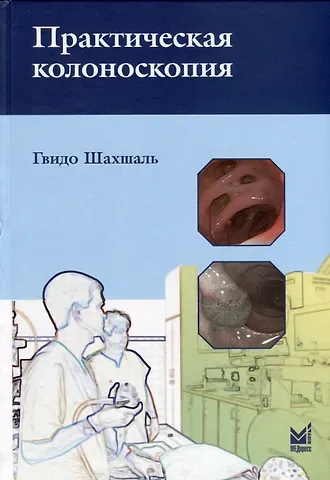 Гвидо Шахшаль Практическая колоноскопия