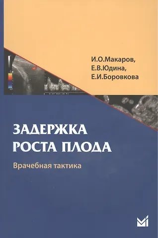Игорь Олегович Макаров Задержка роста плода. Врачебная тактика: Учебн. пособие