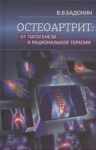 Владимир Васильевич Бадокин Остеоартрит: от патогенеза к рациональной терапии