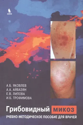 Алексей Борисович Яковлев Грибовидный микоз. Учебно-методическое пособие для врачей